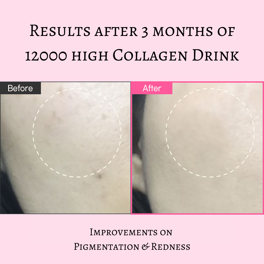 12000 High Collagen Drink - Dewology