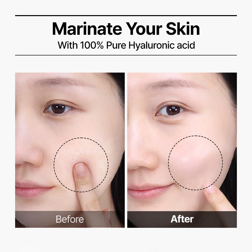Real Hyaluronic Blue 100 Ampoule