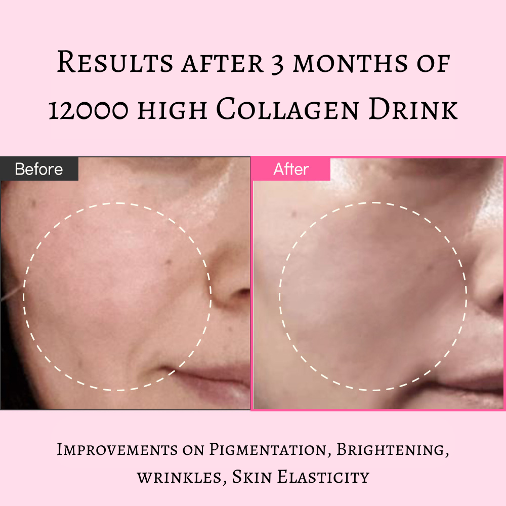 12000 High Collagen Trial Kit (2 bottles) - Dewology