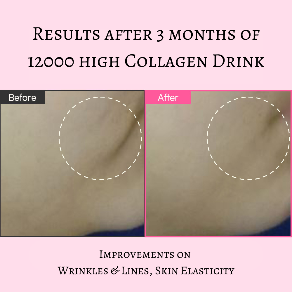 12000 High Collagen Trial Kit (2 bottles) - Dewology